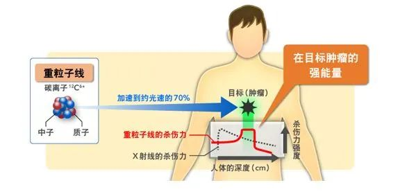 哪些保險可以保普通人“高攀不起”質子重離子治療？插圖10