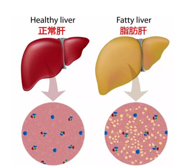 《人民日報》披露體檢異常的前十名，看看你中了嗎？體檢異常保險怎麽購買好？插圖12