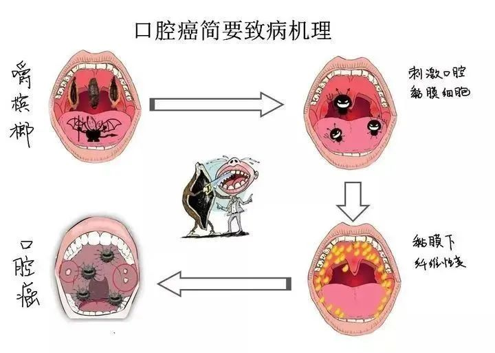 檳榔這類一級致癌物已被下架！普通人應該如何預防癌症？插圖10