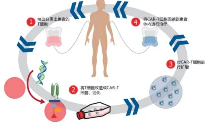 一針就能消除癌症?CAR-T治療到底有多厲害?插圖1 一針就能消除癌症?CAR-T治療到底有多厲害?插圖1