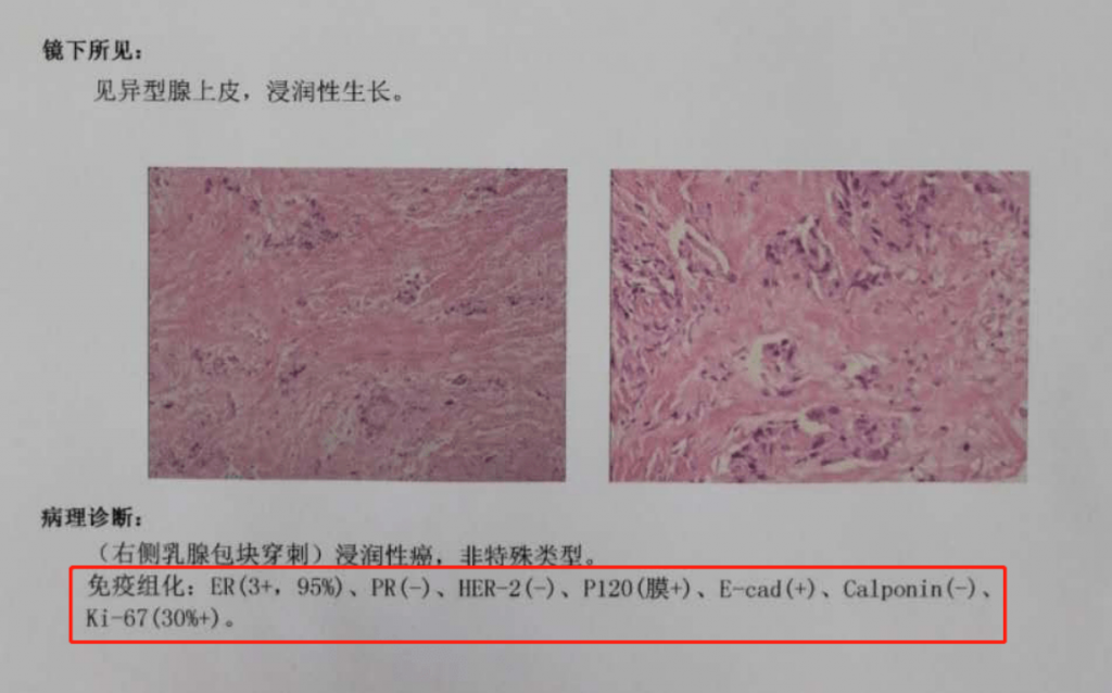 得過乳腺癌也能買的保險，你知道嗎？插圖