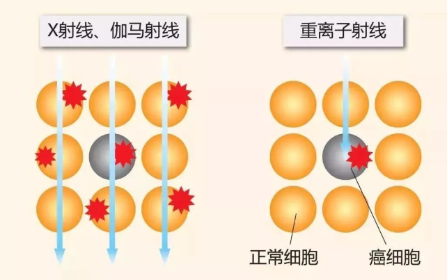 百萬醫療險最常見的六種拒賠情況,你知道幾個?插圖5 百萬醫療險最常見的六種拒賠情況,你知道幾個?插圖5