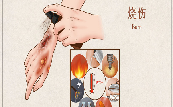 沈陽某酒店發生燃氣爆炸，哪些保險可以為(wei) 燃氣爆炸提供保障？插圖