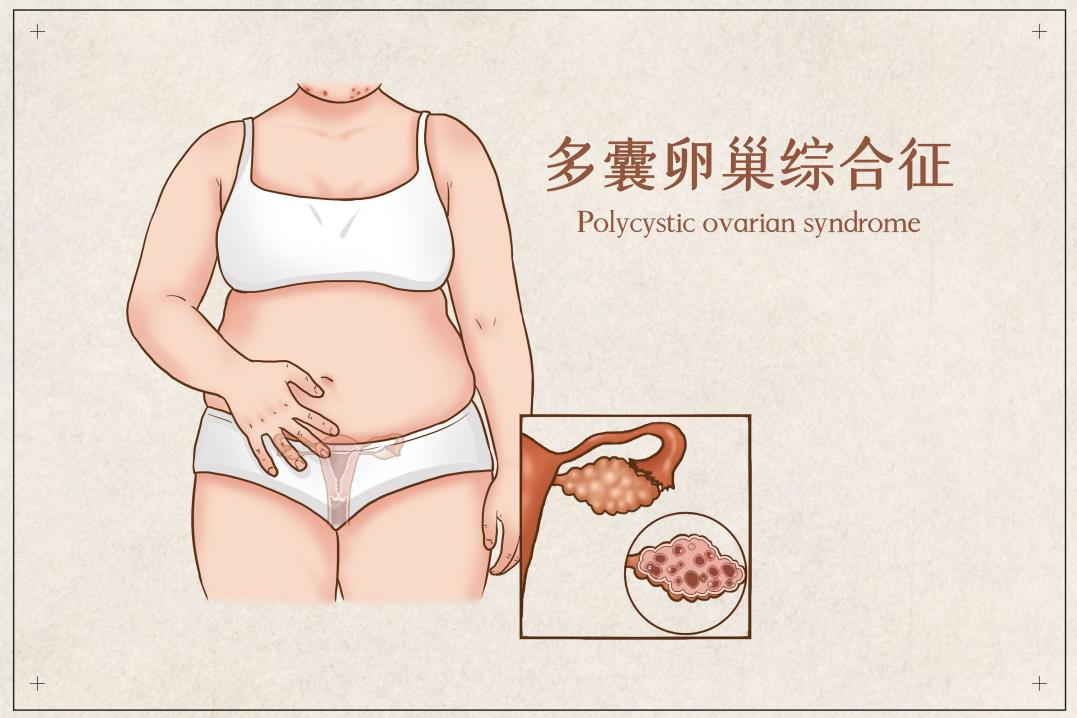 大姨媽為(wei) 什麽(me) 不來？如果是這種病，保險能賠嗎？插圖2