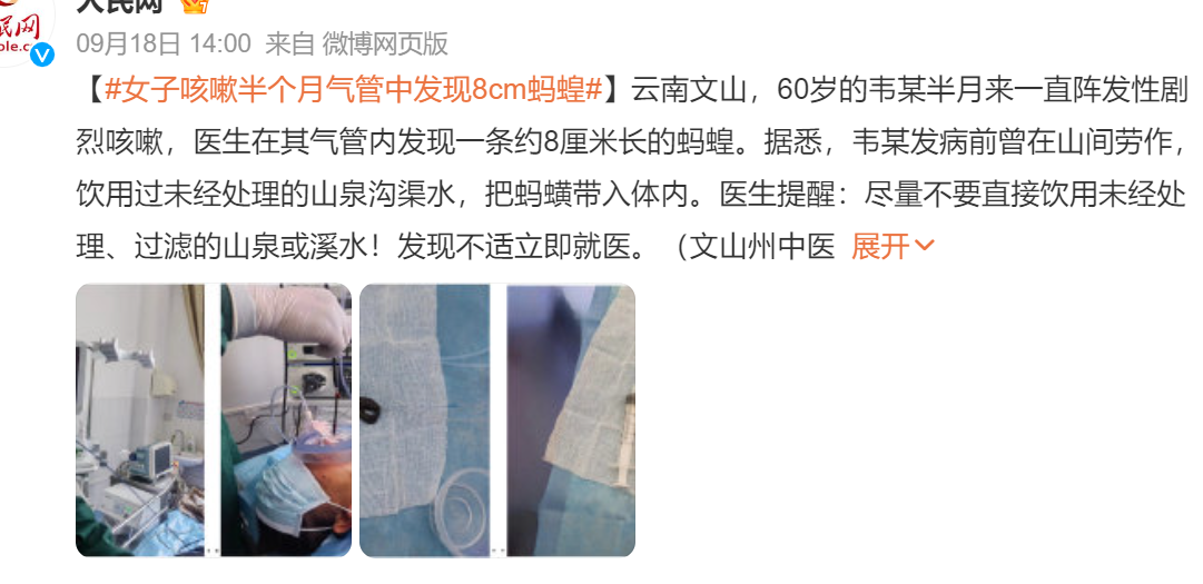 貪吃感染了寄生蟲，治療費保險能賠嗎？插圖3
